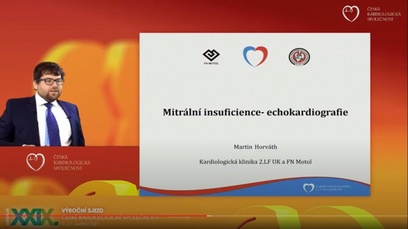 video: CHLOPENN VADY POHLEDEM ECHOKARDIOGRAFISTY