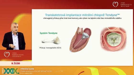 video: PERKUTNN IMPLANTACE MITRLN CHLOPN