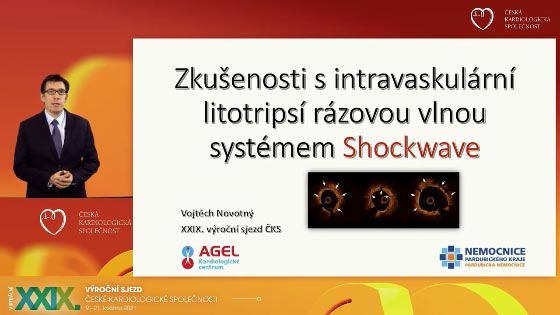 video: ZKUENOSTI S INTRAVASKULRN LITOTRYPS RZOVOU VLNOU SYSTMEM SHOCKWAVE
