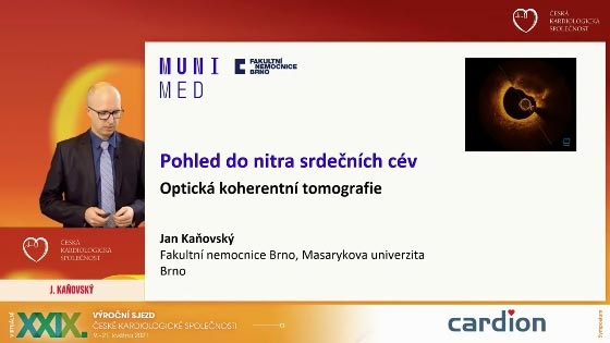 video: POHLED DO NITRA SRDENCH CV - OPTICK KOHERENTN TOMOGRAFIE