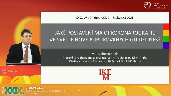video: JAK POSTAVEN M CT KORONAROGRAFIE VE SVTLE NOV PUBLIKOVANCH GUIDELINES?