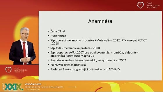 video: KATETRIZAN LBA KOARKTACE AORTY A STENZY AORTLN BIOPROTZY V JEDN DOB