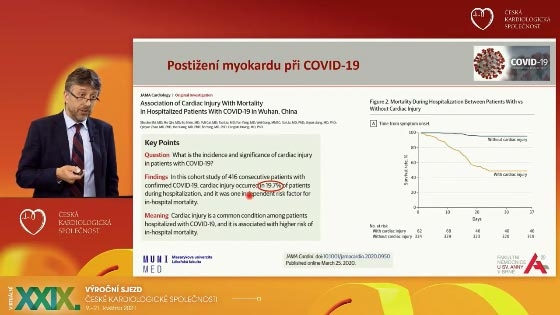 video: BIOPTICK NLEZ PI MYOKARDILNM POSTIEN U COVID 19
