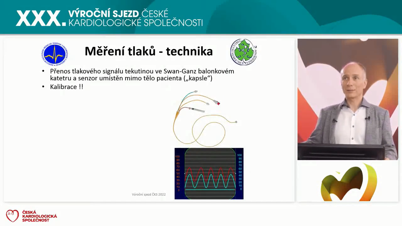 video: HEMODYNAMICK VYETEN V KATETRIZAN LABORATOI