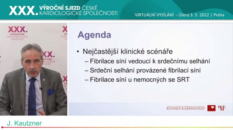 video: SRDEN SELHN A FIBRILACE SN