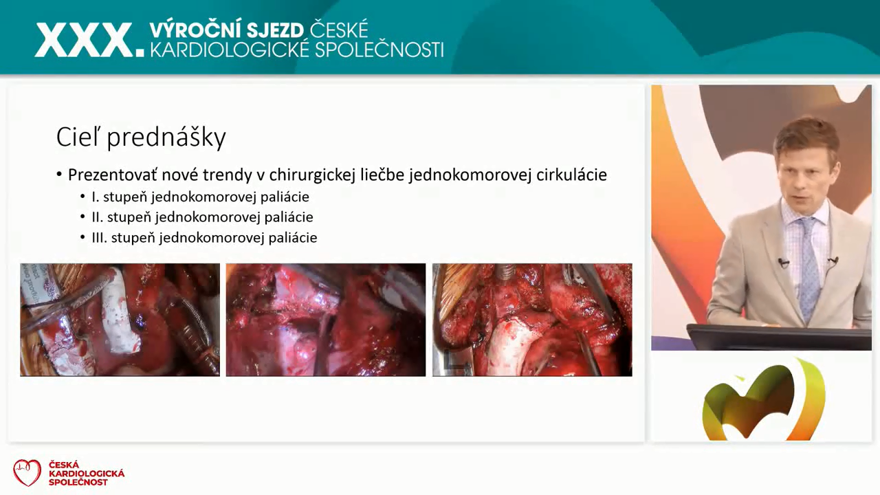 video: MODERN CHIRURGICK PSTUP K JEDNOKOMOROV CIRKULACI