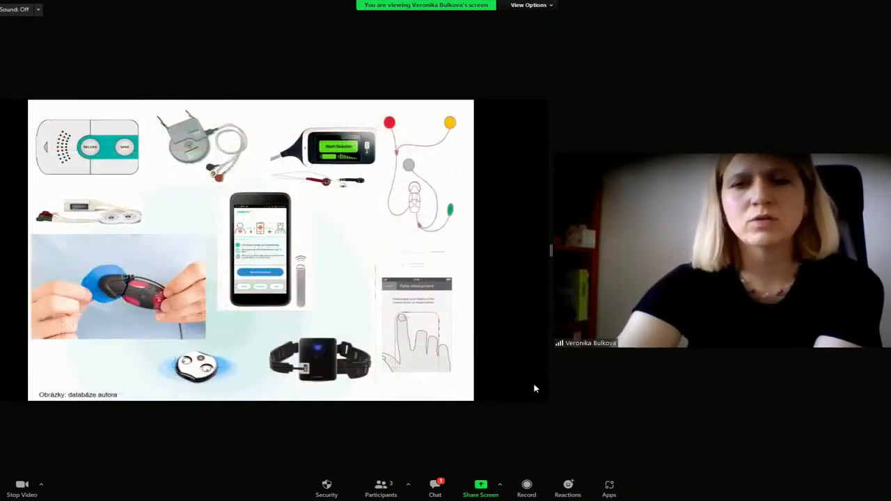 video: KDY ZVAOVAT IMPLANTABILN SRDEN ZZNAMNK?