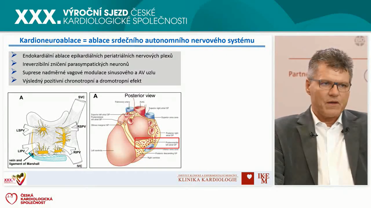 video: U KOHO MَE KARDIONEUROABLACE ZABRNIT IMPLANTACI KARDIOSTIMULTORU?