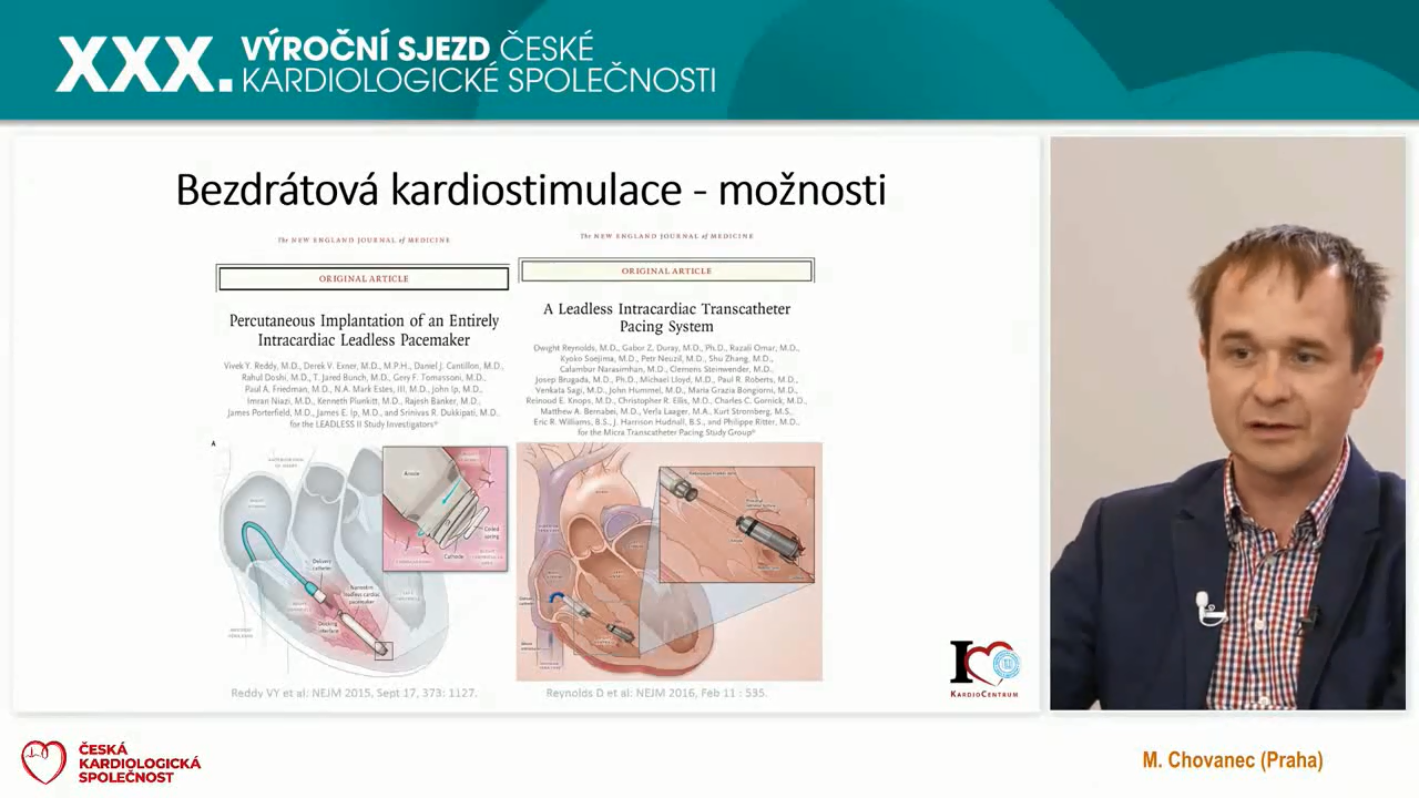 video: LEADLESS STIMULACE ANEB JE AS ZMNIT STIMULAN PARADIGMATA?