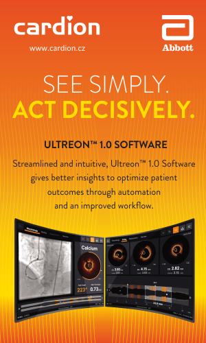 web_banner_Ultreon_Milestone_300x500px.png