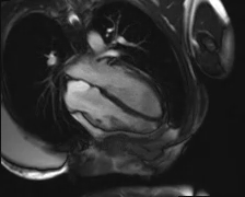 file_5e6a0a570a601_110_video11_MRI-A4CH.mp4.mp4