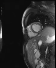 file_5e6a0a618148d_110_video25_MRI-SAX7.mp4.mp4