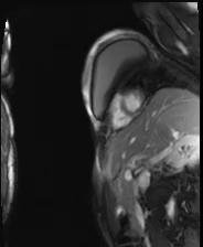 file_5e6a0a62dd86a_110_video28_MRI-SAX10.mp4.mp4