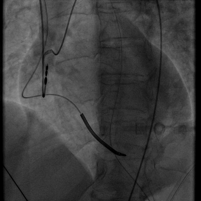 file_5ae972771d83d_66_video_1.avi.mp4