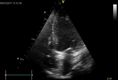 file_5ae9727d3740c_66_video_3.avi.mp4