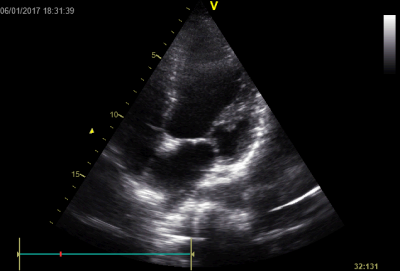 file_5ae9727fe74be_66_video_2.avi.mp4