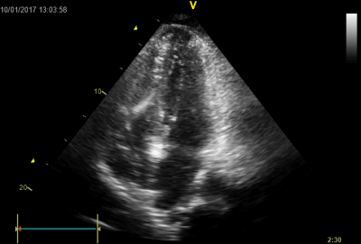 file_5ae972817ba17_66_video_4.avi.mp4