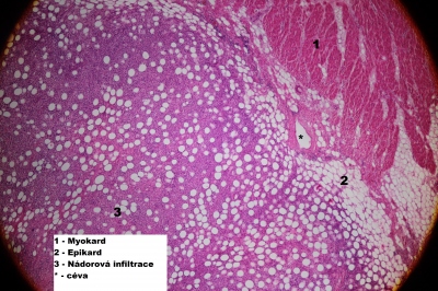 Obr. 4  Histologick prepart ze sekce