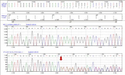 Obr. 6  Vsledek molekulrn genetick analzy: nalezena patogenn varianta v genu pro plakofilin 2 (PKP2): c.1307_1315delinsATTTAGTT p.(Leu436Hisfs*11). erven ipka ukazuje msto mutace. Jedn se o tzv. frame-shift mutaci, kdy delece nebo inzerce nkolika nukleotid zmn tec rmec a pedasn zastav tvorbu kodonu a proteinovou translaci.