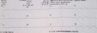 Obr. 1 – Vstupní EKG křivka posádky RLP