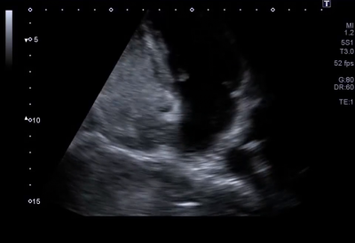 file_6968861fcb3a2_178_Kazuistika_Bronis_Video1.mp4.mp4