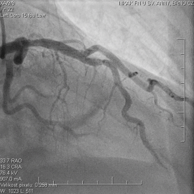 file_696886e9eb731_179_Stipalova,_Video_5,_Odezneni__spasmu_RIA.avi.mp4