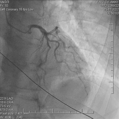 file_696886f0d036a_179_Stipalova,_Video_1,_Vstupni_skg.mp4.mp4