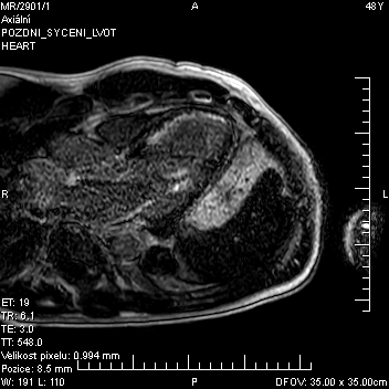 Obr. 1 � Pozdn� sycen� apikosept�ln�.