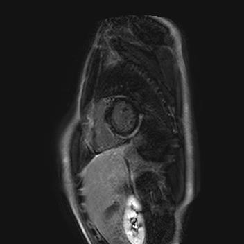 Obr. 3 �MR:neischemick� pozdn� sycen�, 2016.